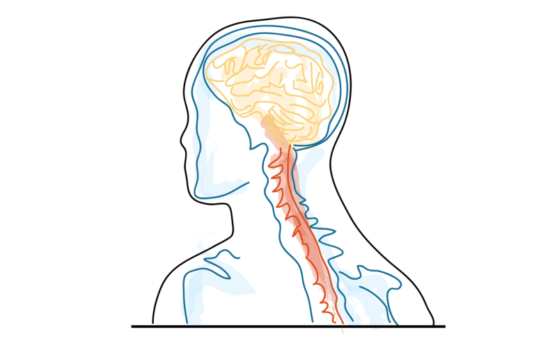 Iyengar yoga video thumbnail: Yoga and Exercise in Multiple Sclerosis