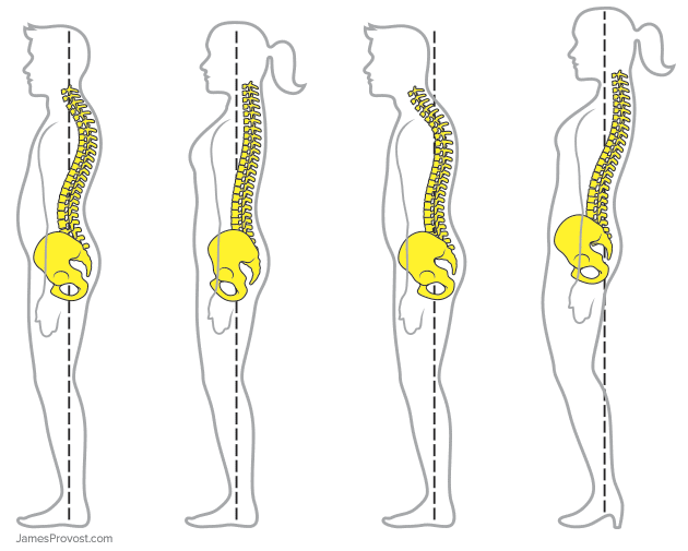 posture problems